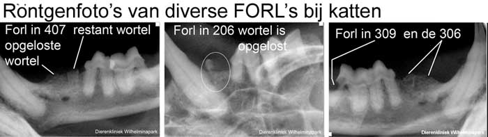 Rontgenfoto's van forls